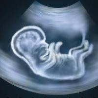 Milyen időpontban jelenik meg az ultrahang terhesség?