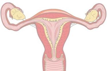 Hogyan lehet megállítani a vérzést a menstruációval otthon?