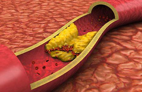 milyen élelmiszerek növelik a koleszterint a vérlistában